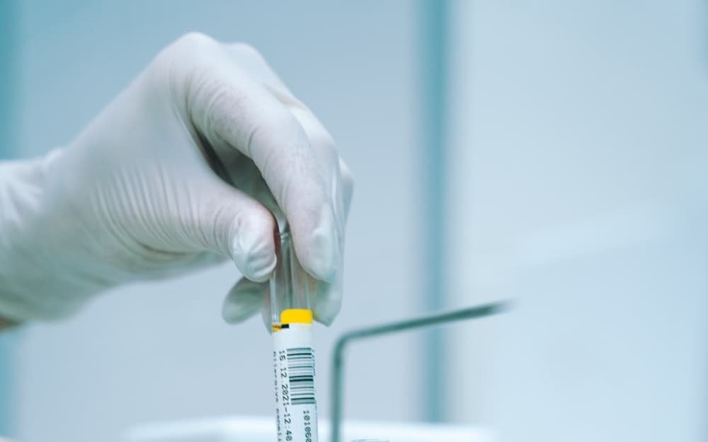 Mão com luva manipulando tubo de coleta em laboratório